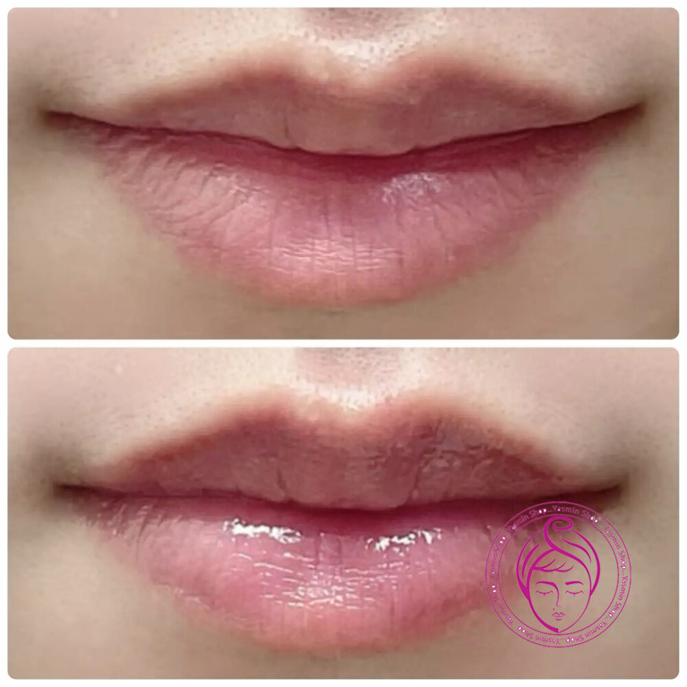 اسنس لب ترمیم‌ کننده و آبرسان سرامید توریدن Torriden SOLID-IN Ceramide Lip Essence - Image 5