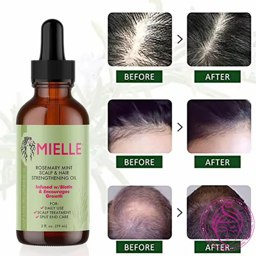 روغن تقویت کننده پوست سر و موی نعناع و رزماری میله Mielle Rosemary Mint Scalp & Hair Strengthening Oil - Image 7