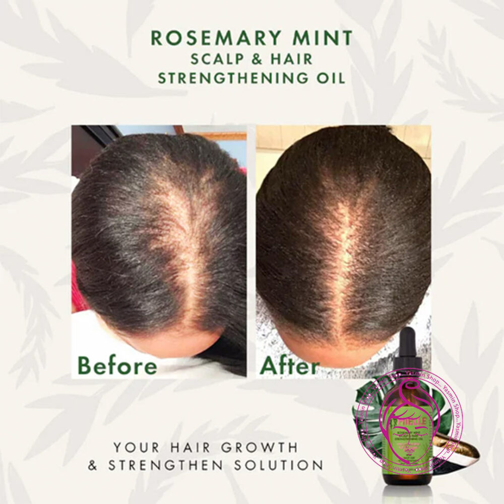 روغن تقویت کننده پوست سر و موی نعناع و رزماری میله Mielle Rosemary Mint Scalp & Hair Strengthening Oil - Image 2