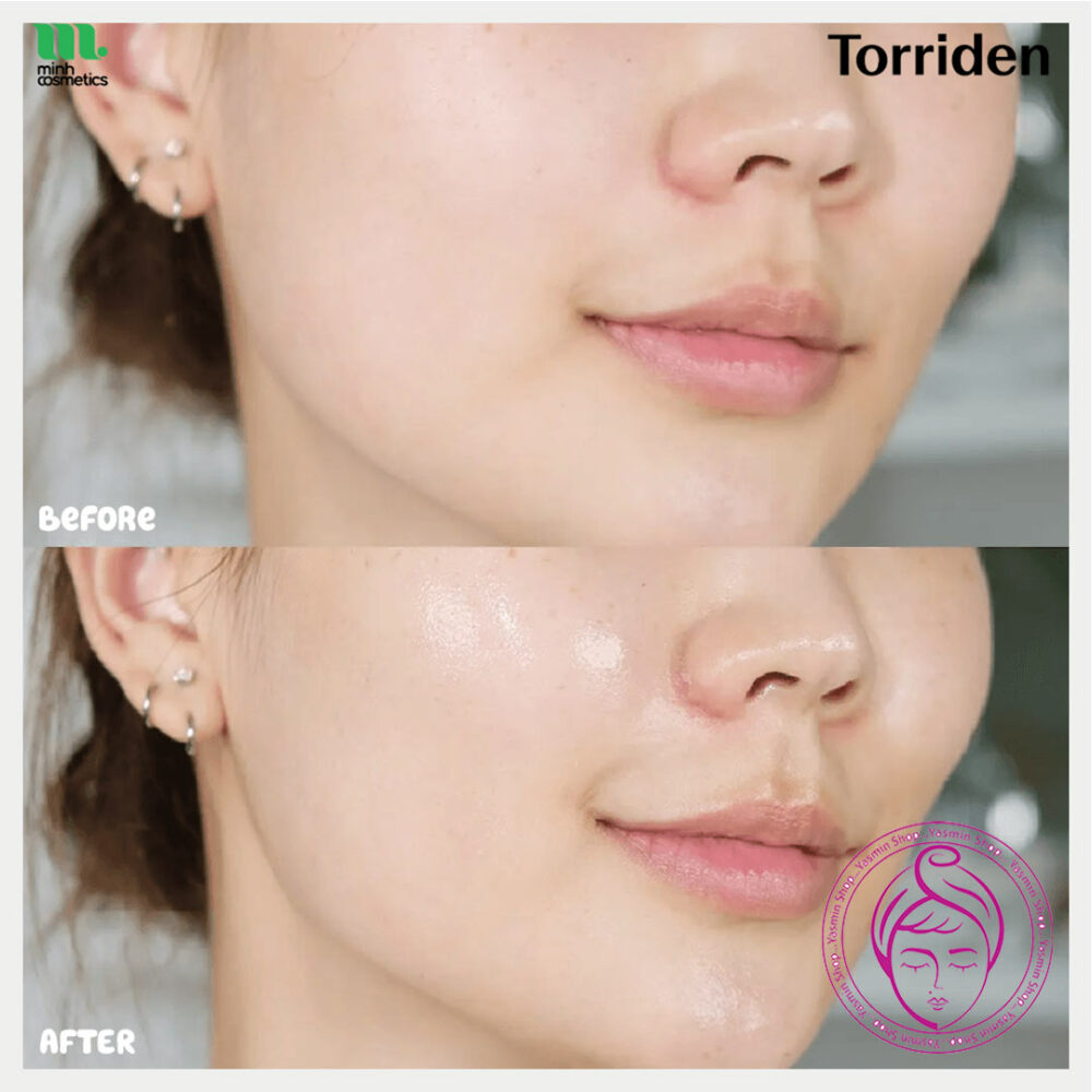 سرم آبرسان هیالورونیک اسید توریدن Torriden DIVE-IN Low Molecular Hyaluronic Acid Serum - Image 4