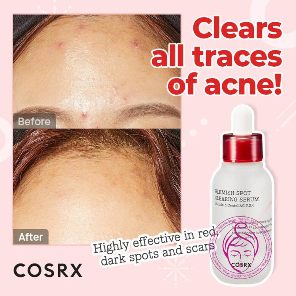 سرم ضد جوش و ضد لکه‌ کوزارکس Cosrx Collection Blemish Spot Clearing Serum - Image 4