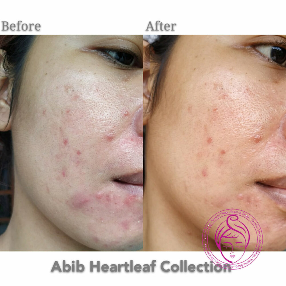 فوم پاک کننده ضد جوش هارتلیف ابیب Abib Acne Foam Cleanser Heartleaf Foam - Image 5