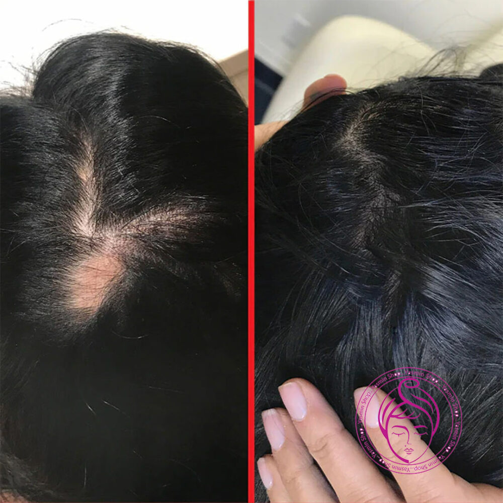 مکمل مولتی ویتامین تقویت موی هیرتامین HAIRtamin Advanced Formula Hair Growth Vitamins - Image 3