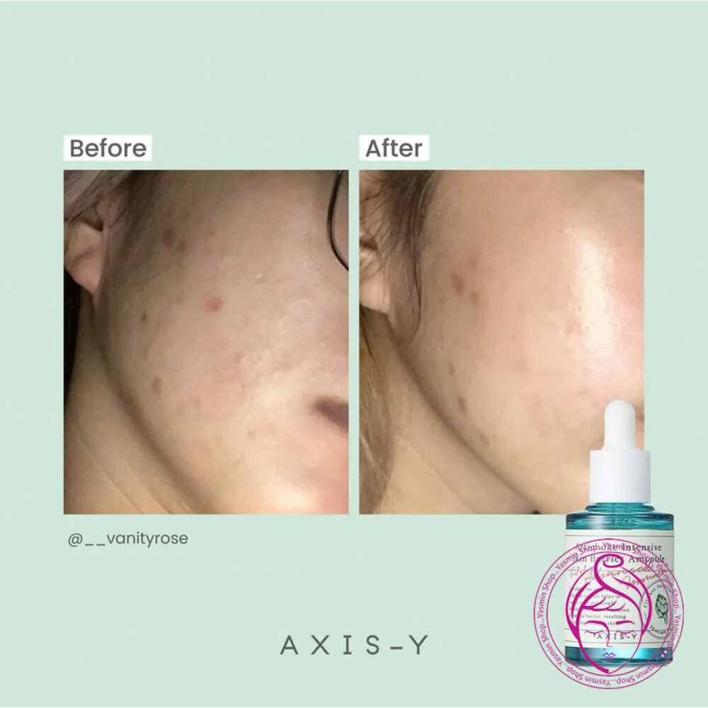 آمپول ترمیم کننده و تقویت کننده سد پوستی عصاره آرتیشو اکسیس وای AXIS-Y Artichoke Intensive Skin Barrier Ampoule - Image 2