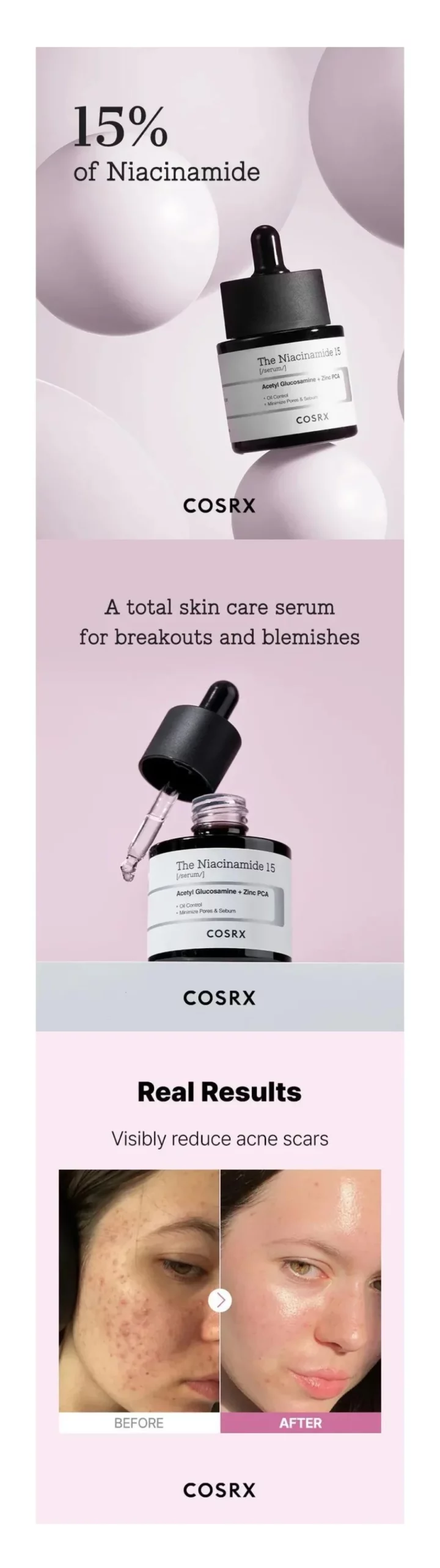 سرم ضدلک و روشن کننده نیاسینامید 15 کوزارکس COSRX The Niacinamide 15 Serum