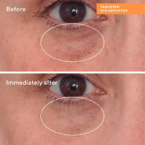 کرم دورچشم دکتر مورد مدل targeted eye depuffer