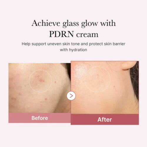 کرم مرطوب‌کننده هیالورونیک PDRN پینک مدی کیوب MEDICUBE PDRN Pink Hyaluronic Moisturizing Cream 50ml