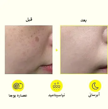 تاثیر کرم ضد لک سام بای می
